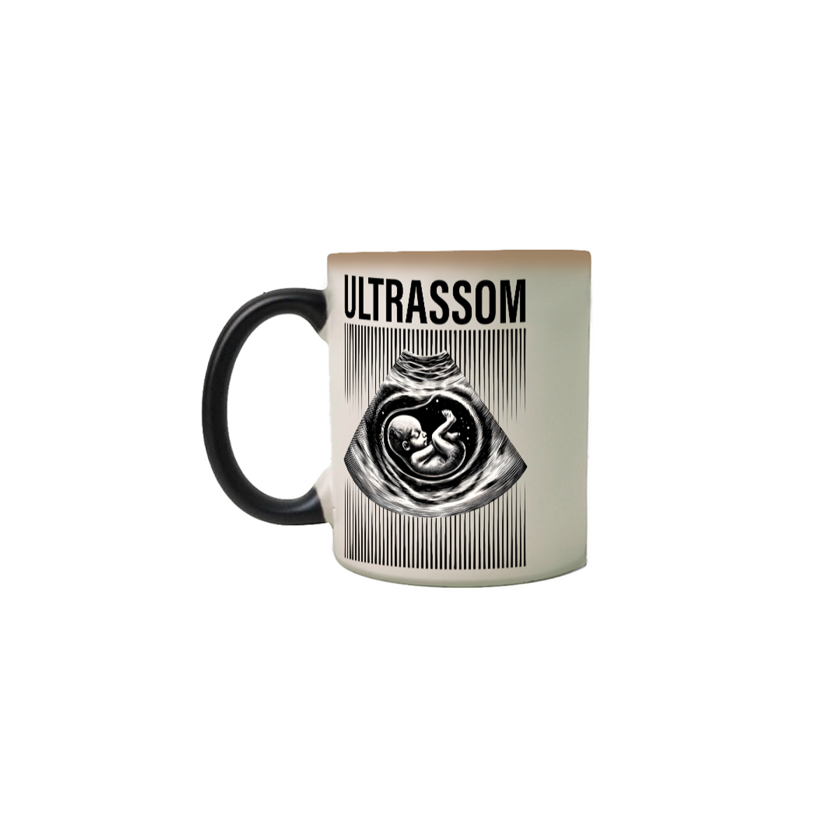 Nome do produto: CANECA MÁGICA - ULTRASSOM BEBÊ