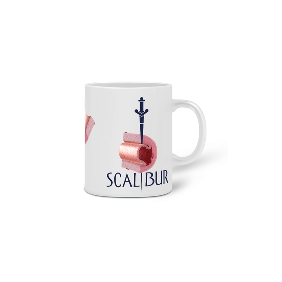 CANECA SCALIBUR - DISSECÇÃO ESPONTÂNEA DA ARTÉRIA CORONÁRIA