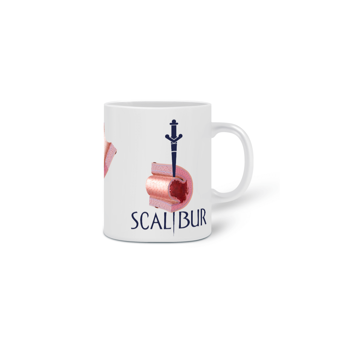 Nome do produto: CANECA SCALIBUR - DISSECÇÃO ESPONTÂNEA DA ARTÉRIA CORONÁRIA