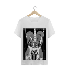 Camiseta Radiografia